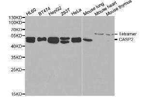 Western blot analysis of extracts of various cell lines, using CASP2 antibody. (Caspase 2 抗体)