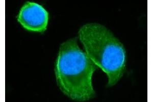 IF analysis of BLNK using anti-BLNK antibody (ABIN7602100). (B-Cell Linker 抗体  (AA 59-456))