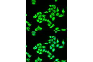 Immunofluorescence analysis of U2OS cells using TPD52L1 antibody (ABIN5973820). (TPD52L1 抗体)