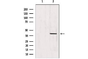 Western blot analysis of extracts from 293, using Caper Antibody. (ATP6AP2 抗体  (Internal Region))