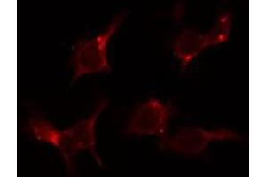 ABIN6279098 staining LOVO by IF/ICC. (AGXT2 抗体  (Internal Region))