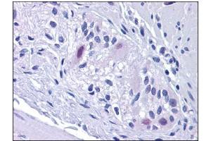 Human Colon, Myenteric Plexus: Formalin-Fixed, Paraffin-Embedded (FFPE) (Retinoblastoma Binding Protein 8 抗体)