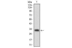 Image no. 1 for anti-CCAAT/enhancer Binding Protein (C/EBP), alpha (CEBPA) antibody (ABIN1497468) (CEBPA 抗体)