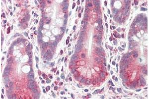 Human Small Intestine: Formalin-Fixed, Paraffin-Embedded (FFPE) (LRRK1 抗体  (AA 474-523))