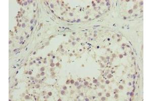 Immunohistochemistry of paraffin-embedded human testis tissue using ABIN7174711 at dilution of 1:100 (TMEM234 抗体  (AA 1-145))