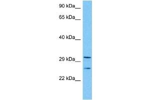 Host:  Mouse  Target Name:  TAL1  Sample Tissue:  Mouse Kidney  Antibody Dilution:  1ug/ml (TAL1 抗体  (Middle Region))
