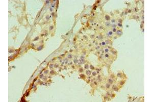 Immunohistochemistry of paraffin-embedded human testis tissue using ABIN7171013 at dilution of 1:100 (SUFUH 抗体  (AA 325-484))