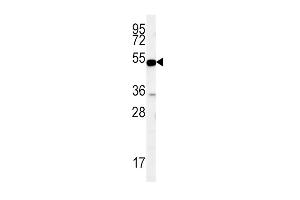 Western blot analysis in MDA-MB435 cell line lysates (35ug/lane). (SLC9A3R1 抗体  (AA 168-197))