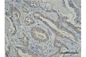Immunohistochemistry (IHC) image for anti-Tumor Necrosis Factor Receptor Superfamily, Member 6b, Decoy (TNFRSF6B) antibody (ABIN2664922) (TNFRSF6B 抗体)