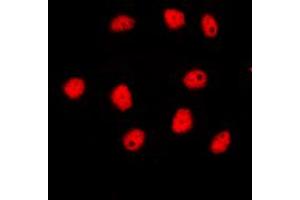 Immunofluorescent analysis of GATA4 staining in HepG2 cells. (GATA4 抗体  (Center))