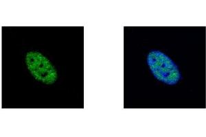 ICC/IF Image NEK4 antibody [N2C1], Internal detects NEK4 protein at nucleus by confocal immunofluorescent analysis. (NEK4 抗体)