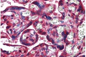 Human Placenta: Formalin-Fixed, Paraffin-Embedded (FFPE)