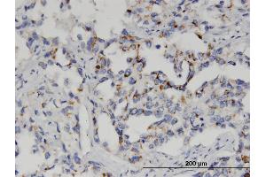 Immunostaining (ISt) image for anti-Glutathione S-Transferase mu 2 (Muscle) (GSTM2) (AA 90-189) antibody (ABIN516230)