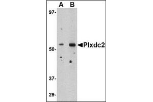 Western blot analysis of Plxdc2 in human brain tissue lysate with this product at (A) 0. (PLXDC2 抗体  (N-Term))
