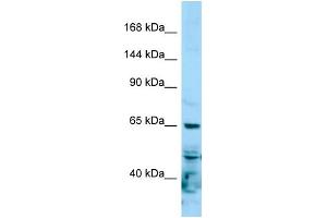 Western Blotting (WB) image for anti-RNA Polymerase II Subunit RPB1 (POLR2A) (N-Term) antibody (ABIN2788998) (POLR2A/RPB1 抗体  (N-Term))