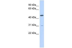 WB Suggested Anti-ZNF238 Antibody Titration:  0. (ZNF238 抗体  (N-Term))