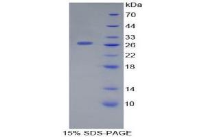 SDS-PAGE (SDS) image for Lectin, Galactoside-Binding, Soluble, 12 (LGALS12) (AA 70-291) protein (His tag) (ABIN2124906)