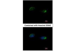 ICC/IF Image Immunofluorescence analysis of methanol-fixed HeLa, using Homer, antibody at 1:500 dilution. (HOMER1 抗体  (Center))
