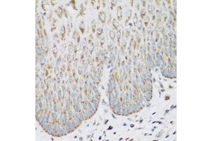 Immunohistochemistry of paraffin-embedded human esophagus using IGF2BP3 antibody (ABIN5972501) at dilution of 1/200 (40x lens). (IGF2BP3 抗体)