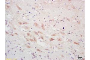 Formalin-fixed and paraffin embedded rat brain labeled with Rabbit Anti PSCA Polyclonal Antibody, Unconjugated (ABIN671676) at 1:200 followed by conjugation to the secondary antibody and DAB staining
