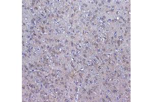Immunohistochemistry (IHC) image for anti-Glutathione S-Transferase mu 3 (Brain) (GSTM3) (AA 93-206) antibody (ABIN5693252)