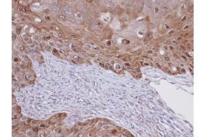 IHC-P Image Immunohistochemical analysis of paraffin-embedded SCC15 xenograft, using IDI1 , antibody at 1:100 dilution. (IDI1 抗体)