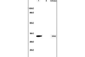 L1 mouse brain lysates L2 mouse heart lysates probed with Anti TNFRSF13B Polyclonal Antibody, Unconjugated (ABIN680488) at 1:200 in 4 °C.