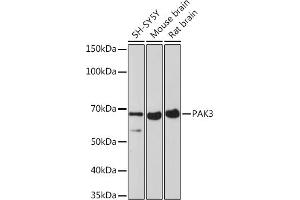Western blot analysis of extracts of various cell lines, using P Rabbit mAb (ABIN7269161) at 1:1000 dilution. (PAK3 抗体)