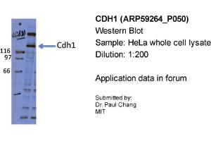 Sample Type: HeLa whole cell lysatePrimary Dilution: 1:200 (E-cadherin 抗体  (Middle Region))