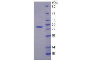 Image no. 1 for Granzyme K (Granzyme 3, Tryptase II) (GZMK) (AA 44-227) protein (His tag) (ABIN6236726) (GZMK Protein (AA 44-227) (His tag))