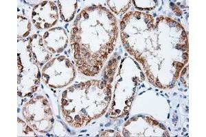 Immunohistochemical staining of paraffin-embedded Carcinoma of prostate tissue using anti-APP mouse monoclonal antibody. (APP 抗体)