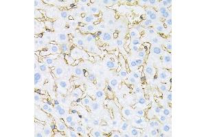 Immunohistochemistry of paraffin-embedded mouse liver using INSR antibody (ABIN5970115) at dilution of 1/100 (40x lens). (Insulin Receptor 抗体)