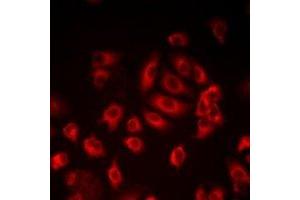 Immunofluorescent analysis of LITAF staining in HepG2 cells. (LITAF 抗体)
