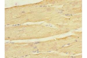 Immunohistochemistry (IHC) image for anti-Potassium Inwardly-Rectifying Channel, Subfamily J, Member 4 (KCNJ4) (AA 316-445) antibody (ABIN7157020)