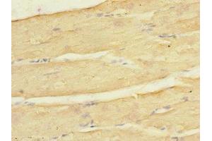 Immunohistochemistry of paraffin-embedded human skeletal muscle tissue using ABIN7157020 at dilution of 1:100 (KCNJ4 抗体  (AA 316-445))