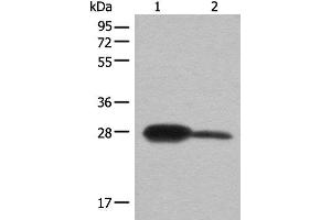 Western blot analysis of Mouse kidney tissue and A172 cell lysates using BDH2 Polyclonal Antibody at dilution of 1:600 (BDH2 抗体)