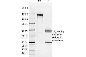 SDS-PAGE Analysis Purified KSP-Cadherin Mouse Monoclonal Antibody (SPM594). (Cadherin-16 抗体)