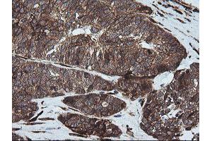 Immunohistochemistry (IHC) image for anti-Formiminotransferase Cyclodeaminase (FTCD) antibody (ABIN1496380) (FTCD 抗体)