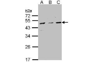 WB Image Sample(30 μg of whole cell lysate) A:293T B:A431, C:H1299 10% SDS PAGE antibody diluted at 1:1500 (CYP7B1 抗体  (C-Term))