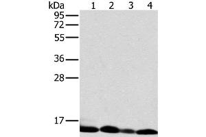 Western Blot analysis of Human liver tissue and K562 cell, Human fetal brain tissue and Raji cell using NDUFS5 Polyclonal Antibody at dilution of 1:400 (NDUFS5 抗体)