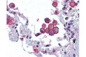 Immunohistochemistry (IHC) image for anti-Transient Receptor Potential Cation Channel, Subfamily V, Member 2 (TRPV2) (C-Term) antibody (ABIN2855207)