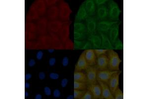 EPS15 Mouse Monoclonal Antibody staining Hela cells by IF/ICC.