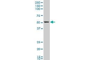 ARHGAP1 polyclonal antibody (A01), Lot # ABNOVA060629QCS1 Western Blot analysis of ARHGAP1 expression in MES-SA/Dx5 . (ARHGAP1 抗体  (AA 340-439))