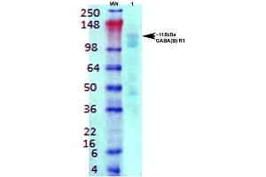 Western Blot analysis of Rat brain membrane lysate showing detection of GABA B Receptor 1 protein using Mouse Anti-GABA B Receptor 1 Monoclonal Antibody, Clone S93A-49 .