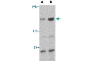 Western blot analysis of CADPS in rat brain tissue lysate with CADPS polyclonal antibody  at (A) 0. (CADPS 抗体  (C-Term))
