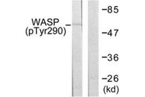Western blot analysis of extracts from HepG2 cells, using WASP (Phospho-Tyr290) Antibody. (WASP 抗体  (pTyr290))