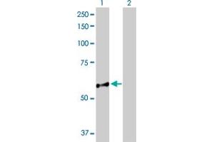 Western Blot analysis of NUP98 expression in transfected 293T cell line by NUP98 MaxPab polyclonal antibody. (NUP98 抗体  (AA 1-606))