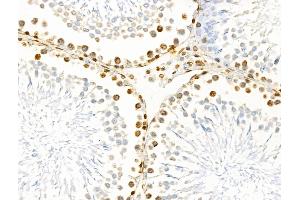 ABIN6261411 and ABIN6266531 at 1/100 staining Rat testis tissue by IHC-P. (E2F4 抗体  (N-Term))