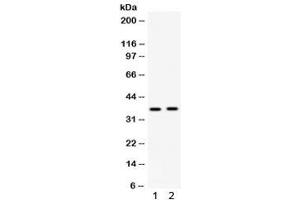 Western blot testing of 1) rat kidney and 2) human HepG2 lysate with Fos B antibody.