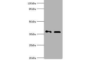 Western blot All lanes: Aldo-keto reductase family 1 member C4 antibody at 7 μg/mL Lane 1: Hela whole cell lysate Lane 2: HepG 2 whole cell lysate Secondary Goat polyclonal to rabbit IgG at 1/10000 dilution Predicted band size: 37 kDa Observed band size: 37 kDa (AKR1C4 抗体  (AA 1-323))